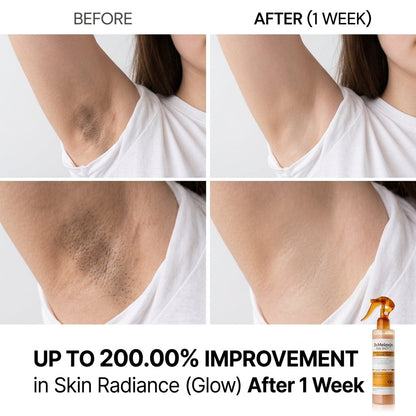 Kojic Acid Turmeric Exfoliating Spray – Body & Foot Glow | بخاخ الكوجيك أسيد والكركم لتقشير وتفتيح البشرة