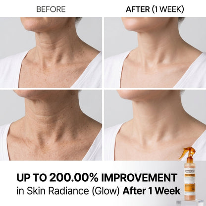 Kojic Acid Turmeric Exfoliating Spray – Body & Foot Glow | بخاخ الكوجيك أسيد والكركم لتقشير وتفتيح البشرة