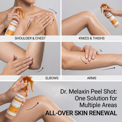 Kojic Acid Turmeric Exfoliating Spray – Body & Foot Glow | بخاخ الكوجيك أسيد والكركم لتقشير وتفتيح البشرة